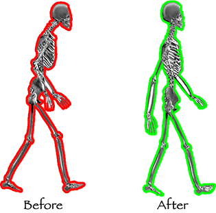 before-after-posture.gif before-after-posture.gif